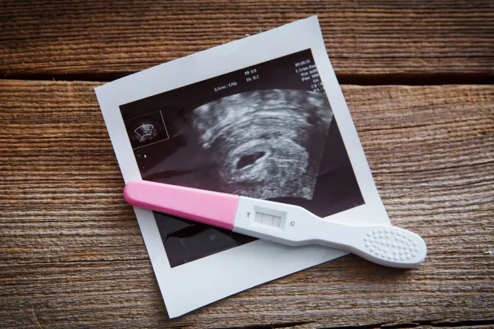Grossesse & transplantation : est-ce possible ?