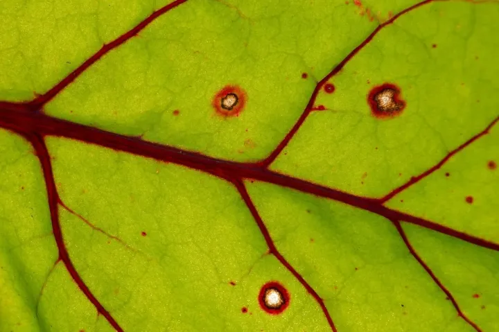 Les 4 accès vasculaires les plus courants pour la dialyse