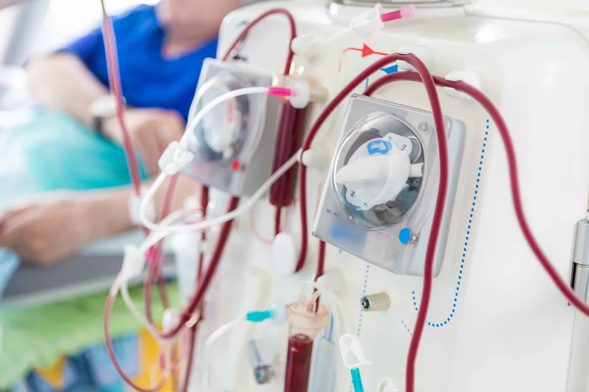 A day in life with hemodialysis