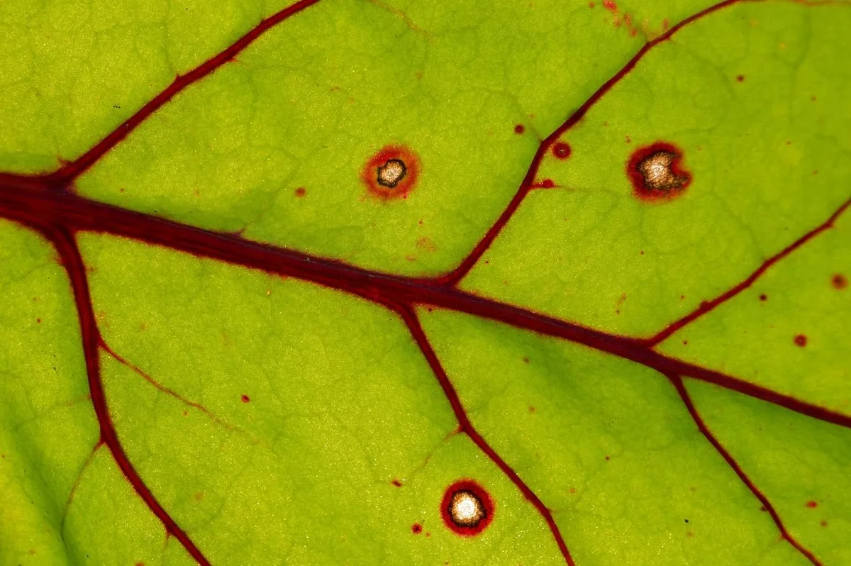 The 4 most common vascular access types for dialysis